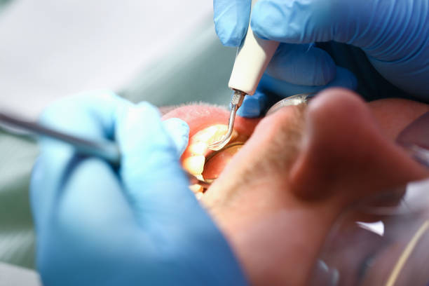 Best Emergency Dentist for Knocked-Out Tooth in Oak Park, CA