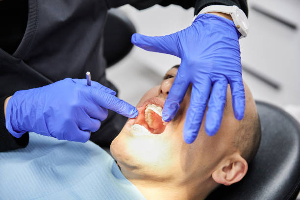 Best Emergency Dentist for Knocked-Out Tooth in Oak Park, CA